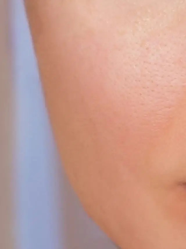 After photo of a patient's skin