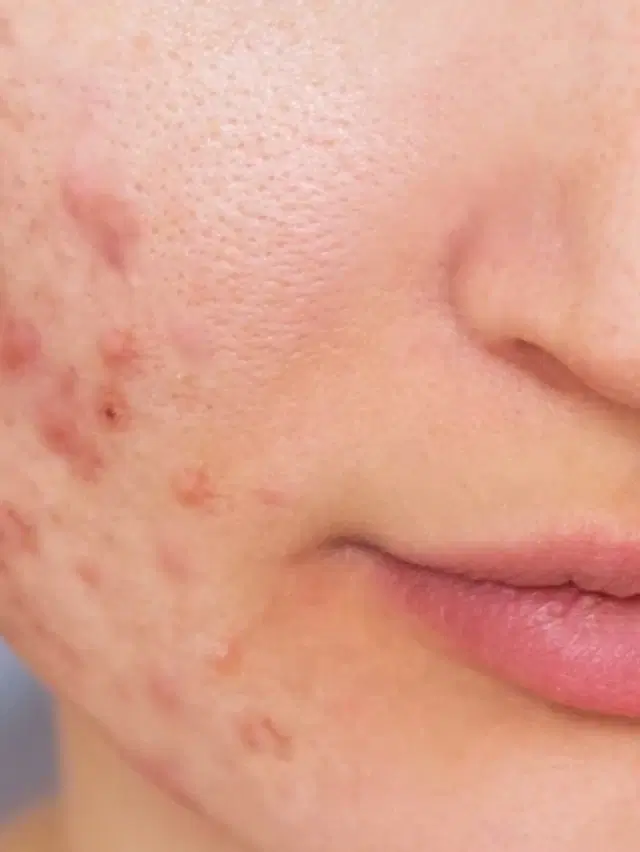 Before photo of a patient's skin